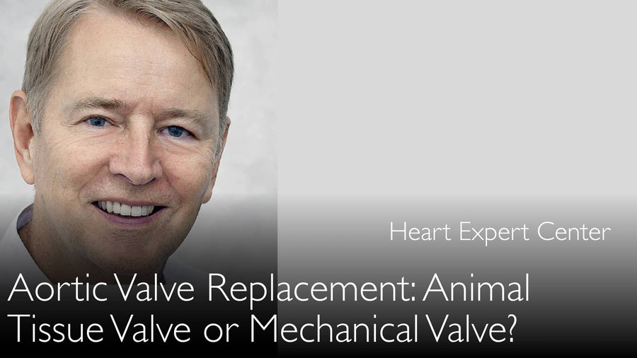 Heart Valve [Aortic, Mitral, Tricuspid]