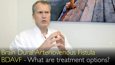 Hirndurale arteriovenöse Fistel (dAVF)