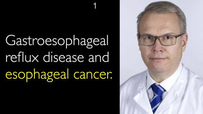 Malattia da reflusso gastroesofageo e cancro esofageo. 1