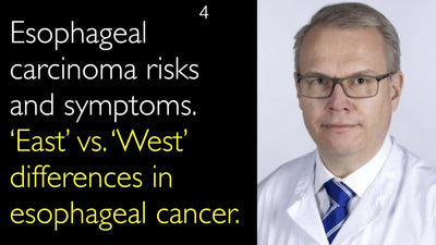 Fattori di rischio e sintomi del carcinoma esofageo. Differenze tra 'Est' e 'Ovest' nel cancro esofageo. 4