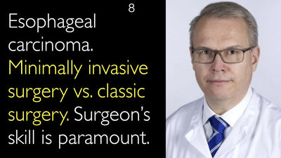 Carcinoma esofageo. Chirurgia minimamente invasiva vs. chirurgia classica. L'abilità del chirurgo è fondamentale. 8