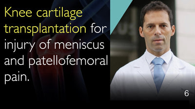 Knieknorpeltransplantation bei Meniskusverletzung. Knorpeltransplantation bei patellofemoralen Schmerzen. 6