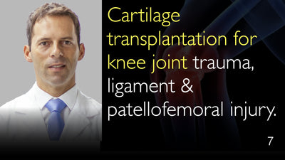 Knorpeltransplantation bei Kniegelenktrauma, Bänder- und Patellofemoralverletzung. 7