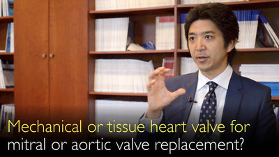 Mechanische oder biologische Herzklappe für den Mitral- oder Aortenklappenersatz? Gestentete oder stentlose Herzklappe?