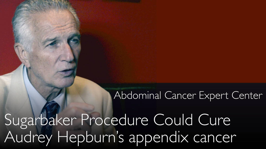 Audrey Hepburn's appendix cancer could be cured today. Sugarbaker Procedure. 2